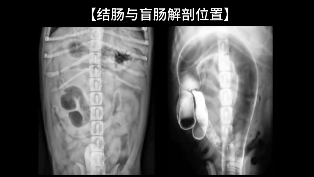 犬猫盲肠-结肠超声检查分析