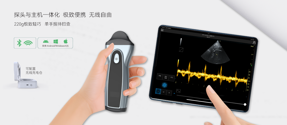 极简集成，定义“口袋超声”新标准